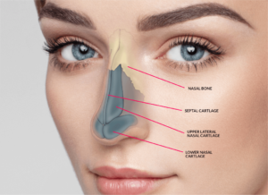 Rhinoplasty Surgery in Pune