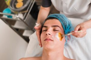 chemical peels treatment