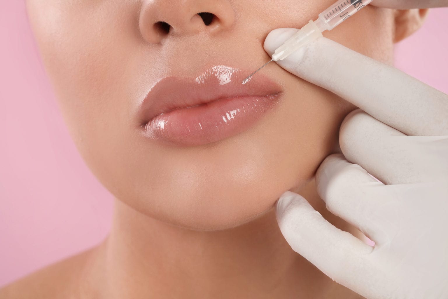 lip fillers treatment