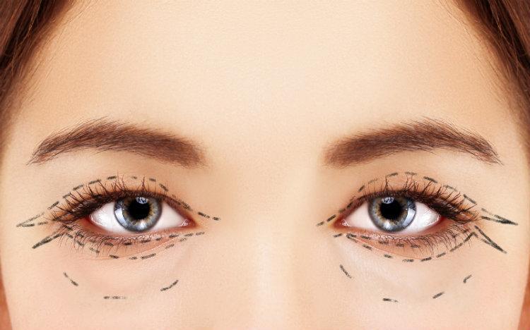 lower and upper eyelid