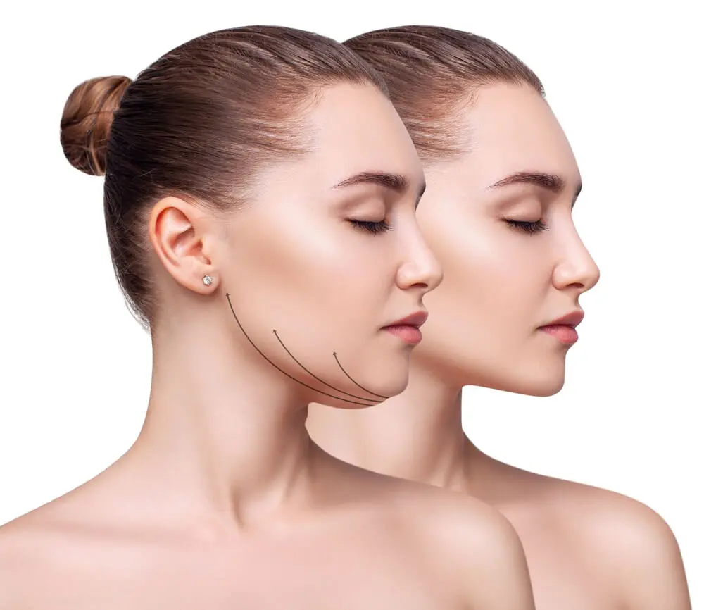 Face Slimming Surgery