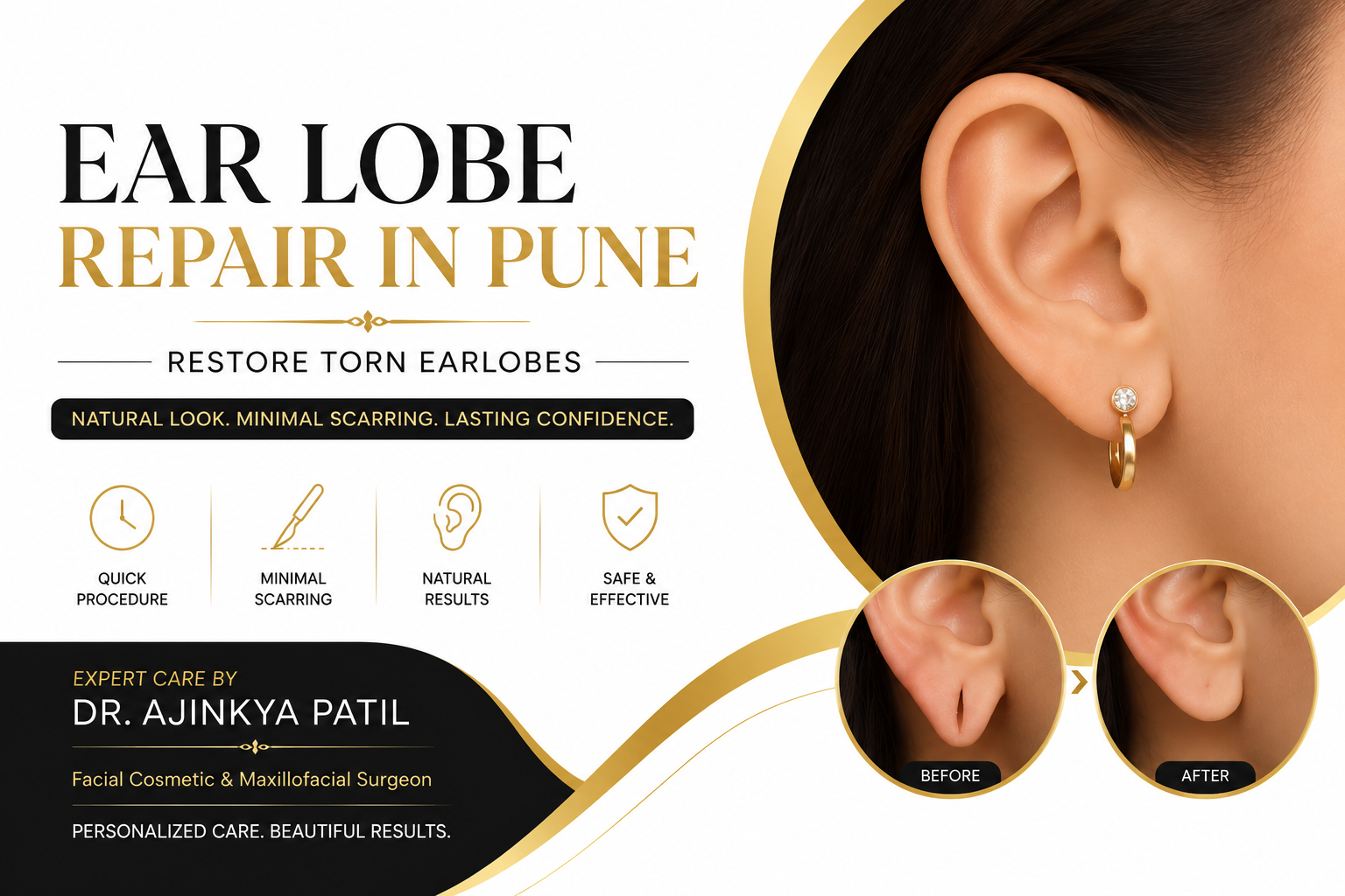 Ear Lobe Repair in Pune