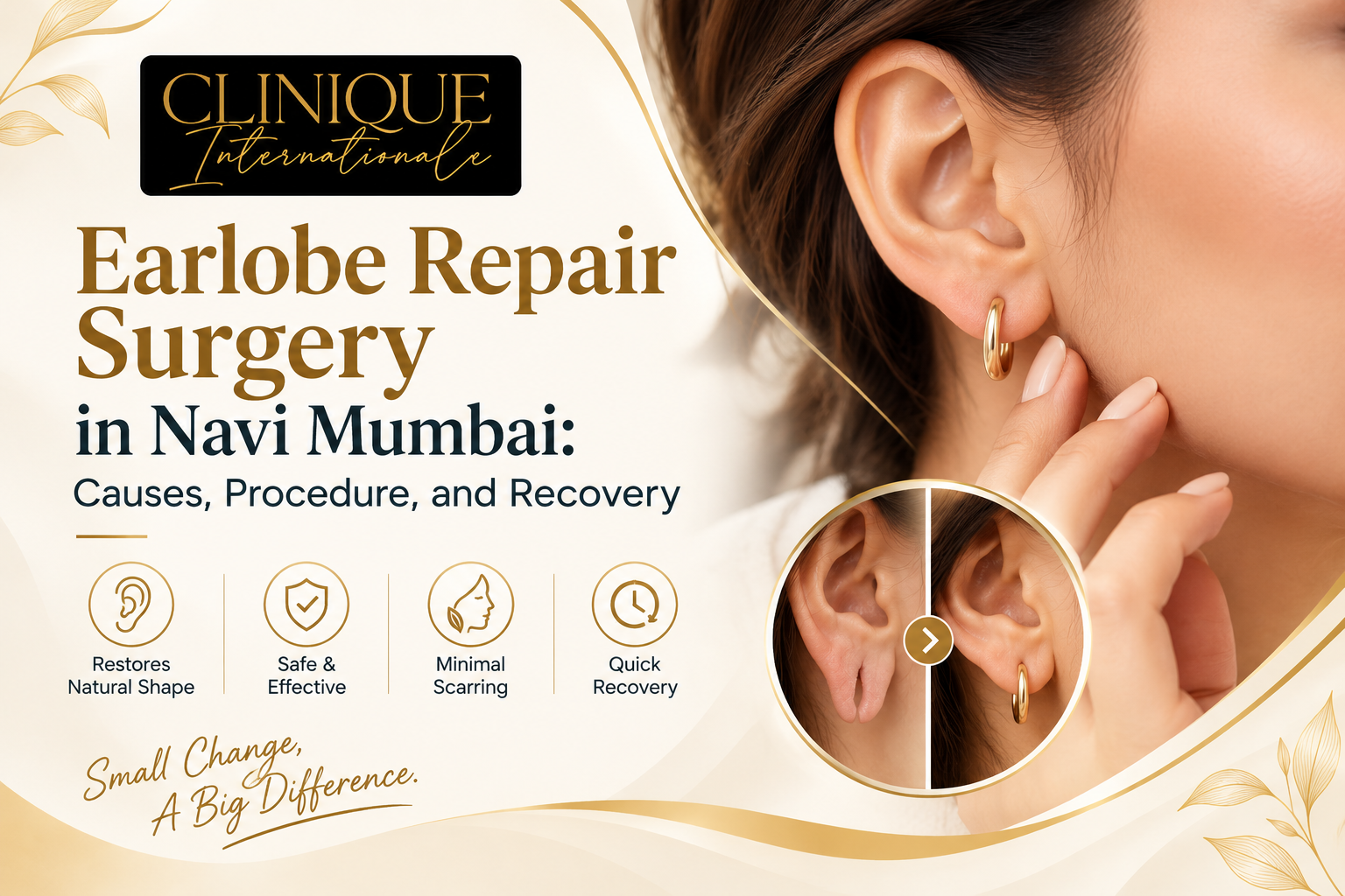 Earlobe Repair in Navi Mumbai